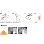 Diadent Dia-Proseal Root Canal Sealer – Calcium Hydroxide Antimicrobial High pH Biocompatible Sealer
