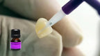 Monobond N 5ml dental bonding primer compatible with zirconia alumina metal and composite restorations
