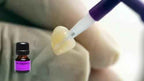 Ivoclar Monobond N – Crown Veneer Inlay Onlay Bonding Indirect Restoration Pretreatment
