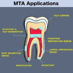 Prime MTA BioPutty – Low Solubility Mechanical Resistance Bioceramic India Made Prime Dental Products
