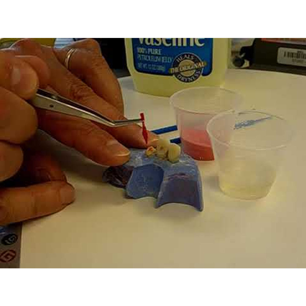 GC Pattern Resin Flammable Acrylic Resin Kit for Dental Lab Use – GC Corporation Japan