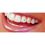 Skyce tooth gems bonded to labial surface upper anterior teeth non-invasive procedure