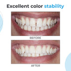 Waldent NanoFill Zirconium packable composite kit for anterior and posterior restorations